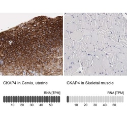 CKAP4/p63 Antibody, Novus Biologicals 0.1mL; Unlabeled:Antibodies, Polyclonal